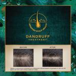 Indulekha Svetakutaja Ayurvedic Hair Oil 100 ml Ayurvedic Medicinal oil for dandruff treatment with Svetakutaja-Comb Applicator Bottle for Men & Women